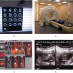 113abcd_Medical_Imaging_Techniques