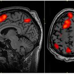 Beyin-fMRI